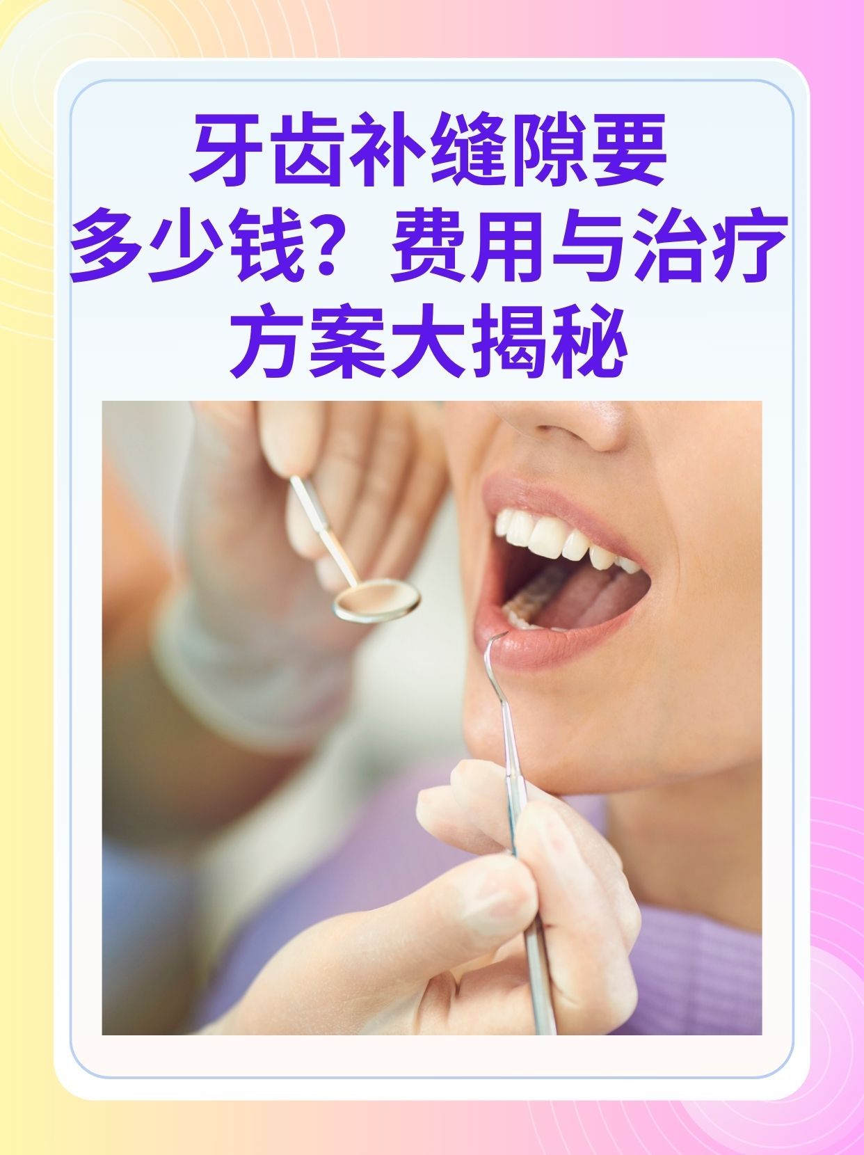 安康补牙医保可以报销吗(补牙医保可以报销吗 哪些可以报销呢)